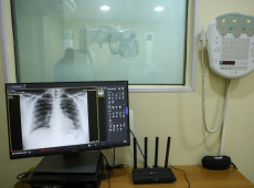 Brasil tem aumento de hospitalizações por Influenza A, alerta Fiocruz
