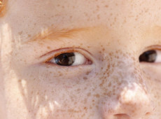 Reflexo branco nos olhos: entenda condição que assusta pais 