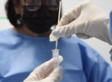 RJ: cenário epidemiológico de covid-19 tem tendência de redução