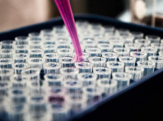 Pesquisas brasileiras avançam no diagnóstico de Alzheimer 