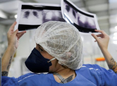 Brasil deve ter 781 mil novos casos de c&acirc;ncer por ano at&eacute; 2028