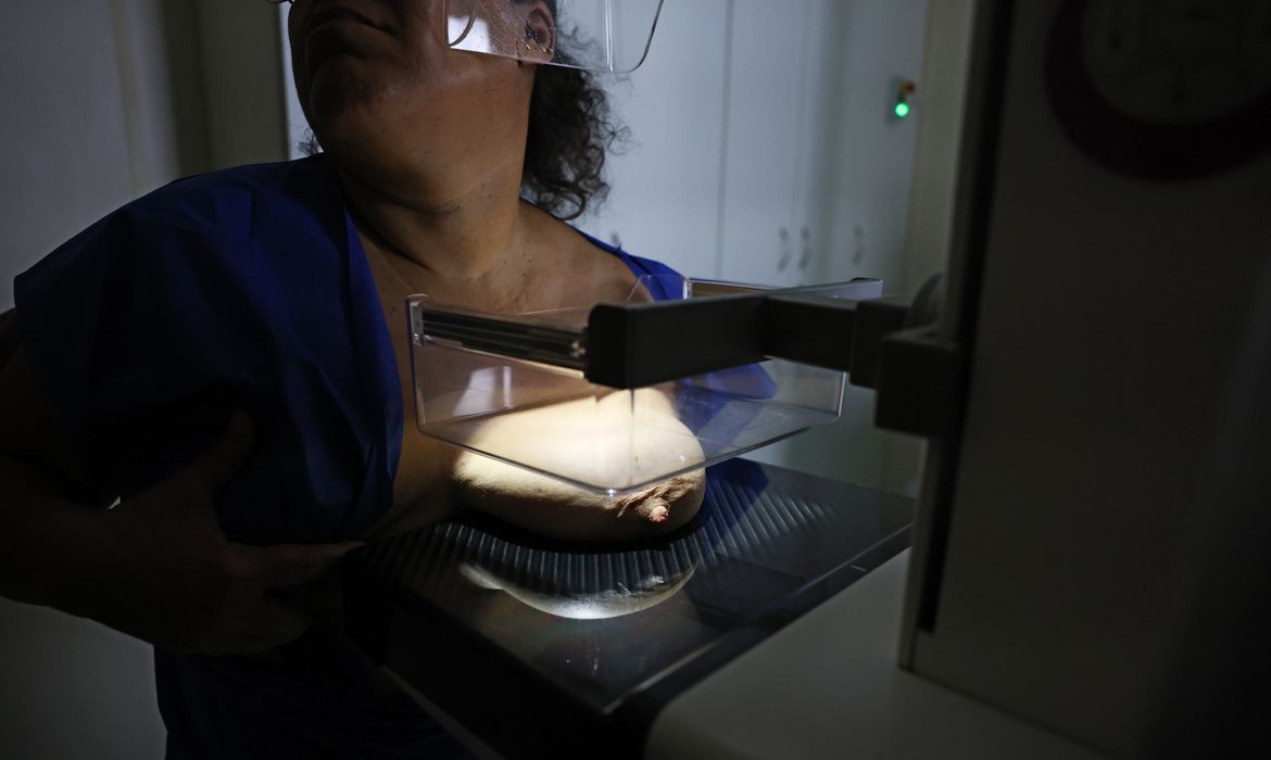 Vigitel: 92% das brasileiras entre 50 e 69 anos fizeram mamografia