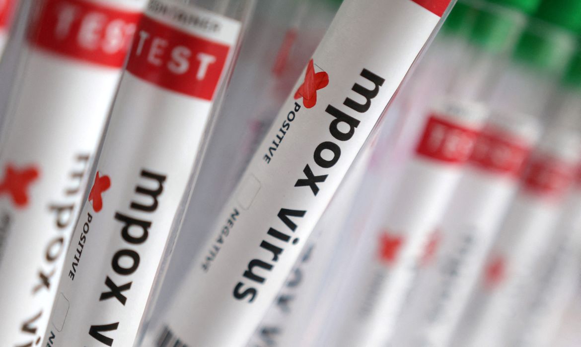 Sobe para 140 número de casos confirmados de Mpox no país, em 2026