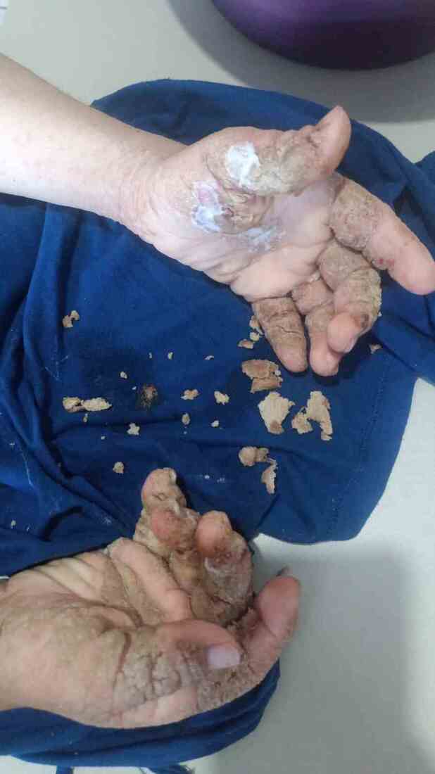 Apaixonado por m&uacute;sica e dan&ccedil;a, Cristian hoje enfrenta dor e isolamento enquanto aguarda exame fundamental para sua recupera&ccedil;&atilde;o