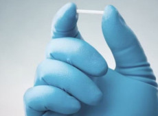 Mulheres canoinhenses recebem Implanon, contraceptivo.