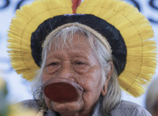 Raoni faz transi&ccedil;&atilde;o para dieta oral e tem evolu&ccedil;&atilde;o no quadro de sa&uacute;de