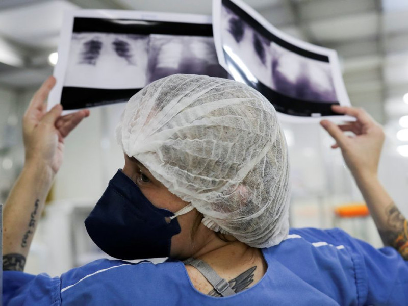 Diagn&oacute;stico tardio d&aacute; poucas chances de cura para o c&acirc;ncer de pulm&atilde;o 